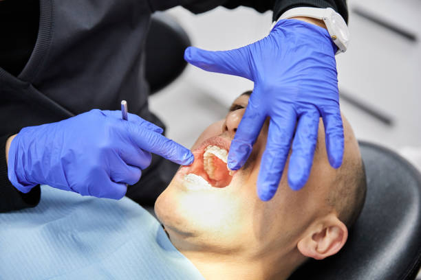 Best Emergency Gum Treatment in Carolina Shores, NC