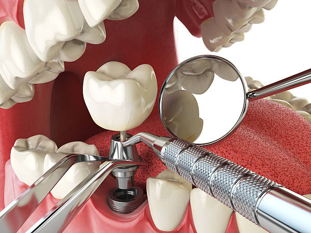 Best Emergency Denture Repair in Carolina Shores, NC